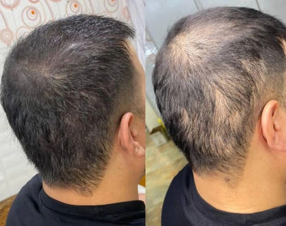 RoSaCaPiL: Huile AntiChute Premium 5en1